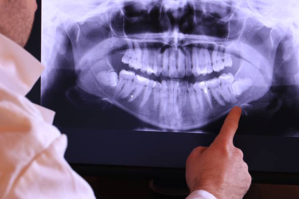 Best Emergency Treatment for Dental Infections or Abscesses in Norcross, GA